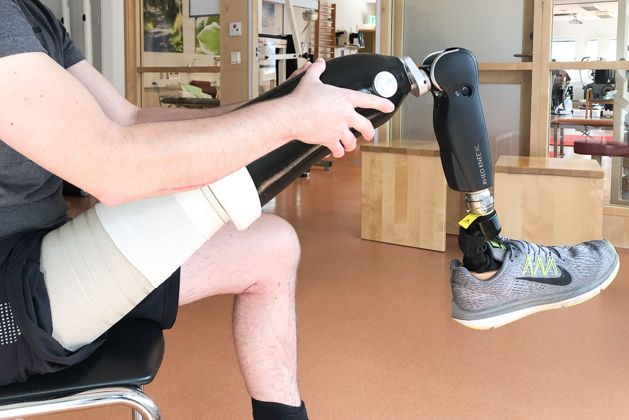 En person trär på en benprotes på sitt ena ben.