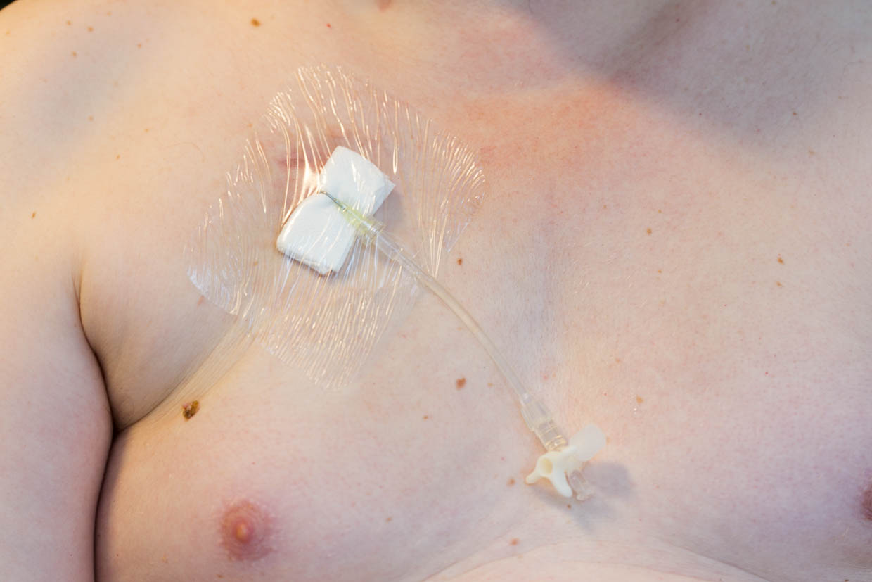 Högt upp på bröstet sitter venporten.